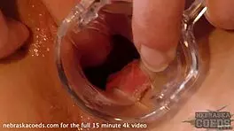 Wow! Teen Blonde Sarah's Pussy Gaped with Speculum in Closeup