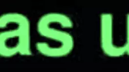 熟女肛门拳交粗暴肛交，我的脉搏加速