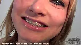 hey, check out this nervous teen 18+ in public, stripping panties to show her pink pussy and masturbating shyly outdoors with braces 😳👀